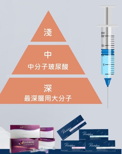 治療方式之一 : 玻尿酸填充