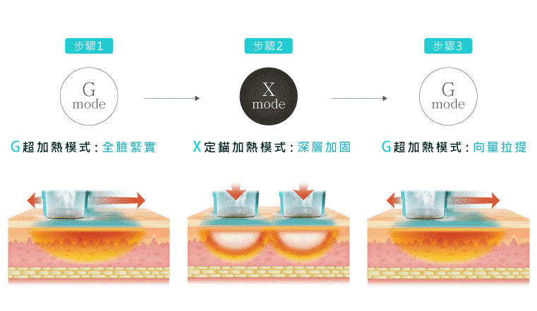 Oligio X 超玩美電波<br>嶄新科技 GXG 模式