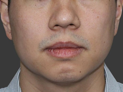 After Image